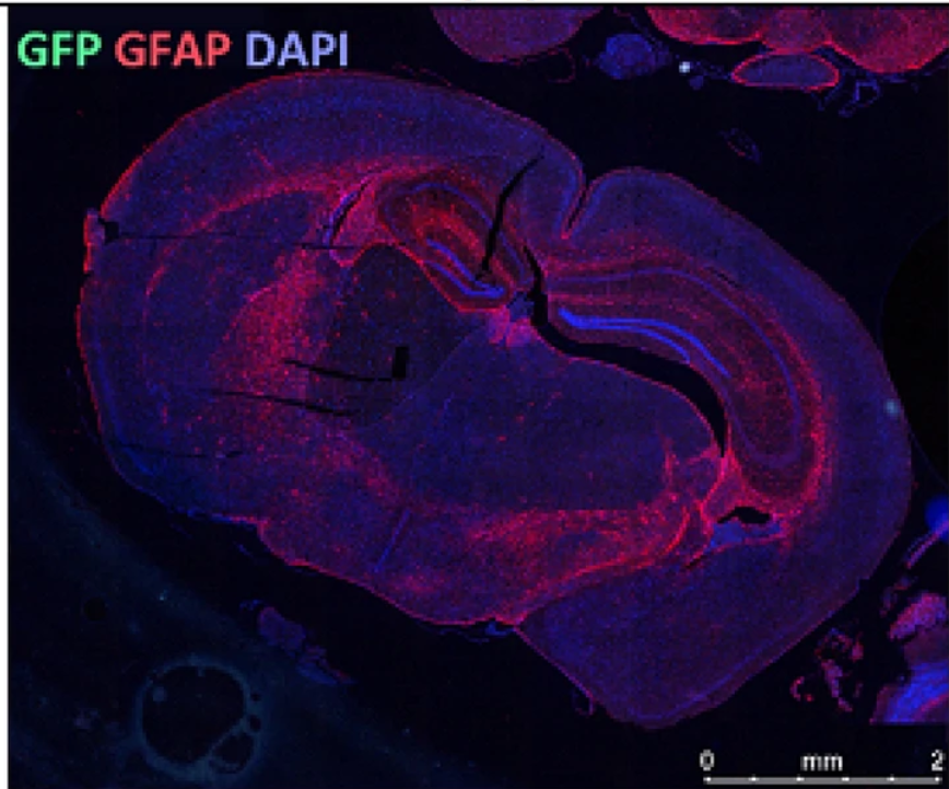 کاهش اختلال حرکتی اولیه در موش‌های  مبتلا به اسکلروز جانبی آمیوتروفیک توسط پیوند سلول‌های پیش‌ساز گلیال موش و فاکتور پیش از لانه‌گزینی مصنوعی